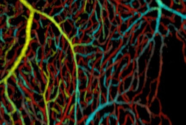 Imagen que muestra pequeños vasos sanguíneos dentro de tres capas diferentes de mácula: capa de células ganglionares (amarillo y azul), capa plexiforme interna (verde), y capa plexiforme externa (rojo).